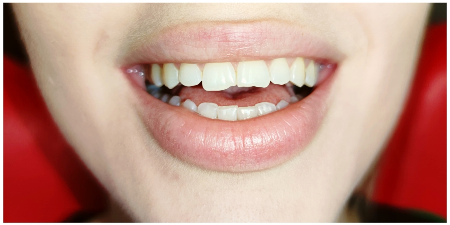 Design fără titlu (32) Design fără titlu (32)