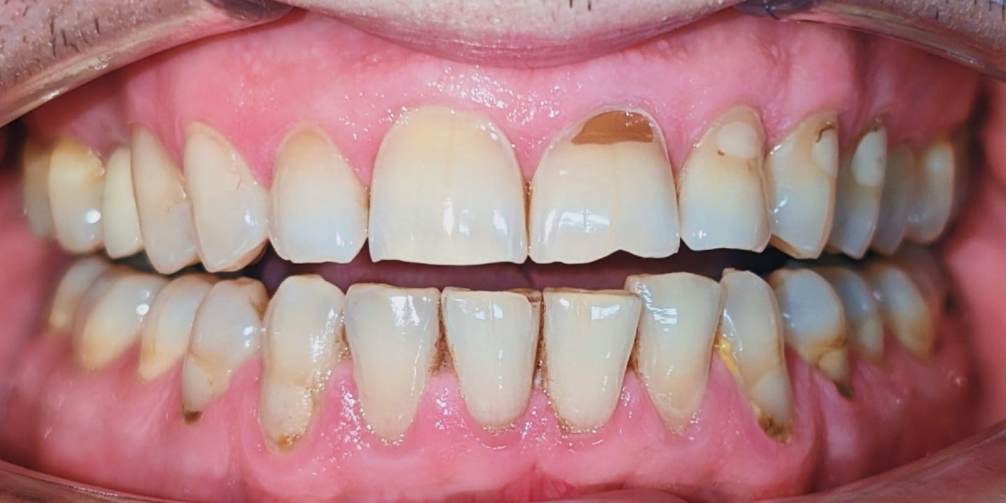 Design fără titlu (38) Design fără titlu (38)