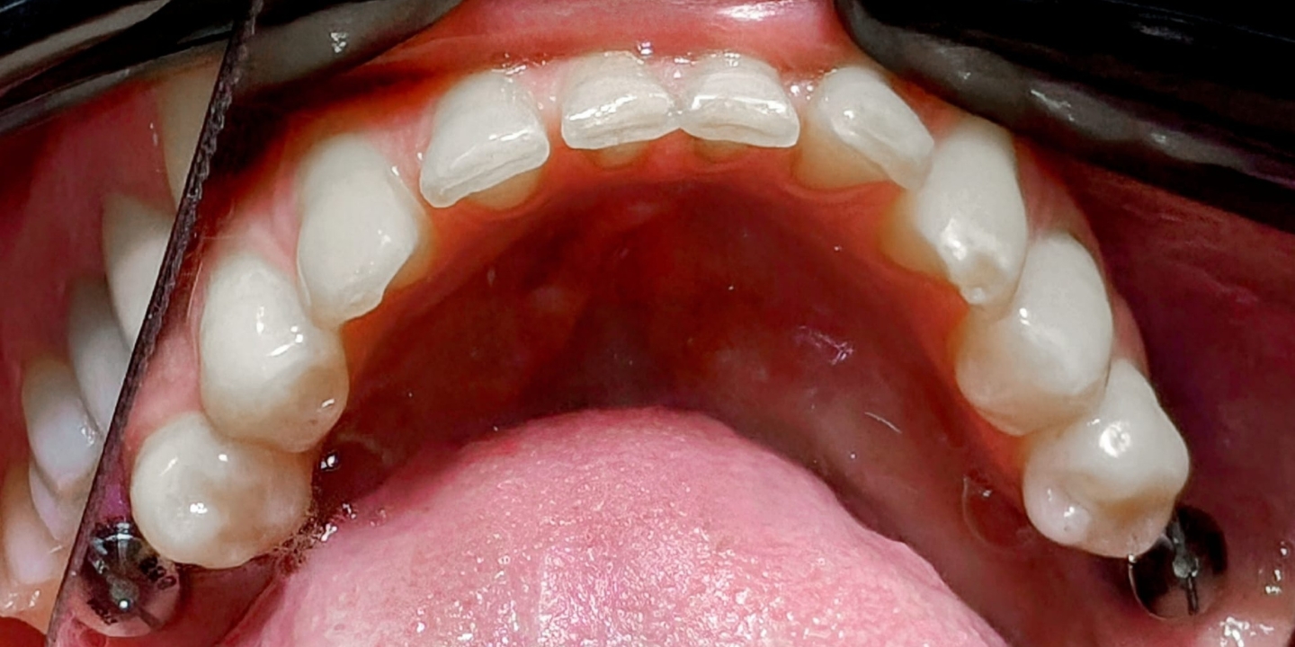 Design fără titlu (58) Design fără titlu (58)