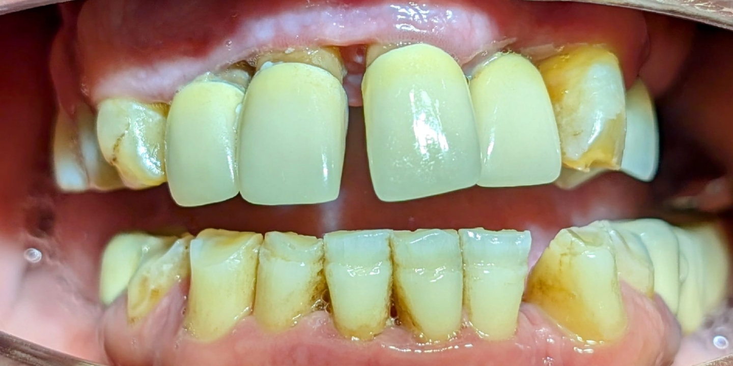 Design fără titlu (59) Design fără titlu (59)